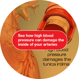 HBP and the arteries